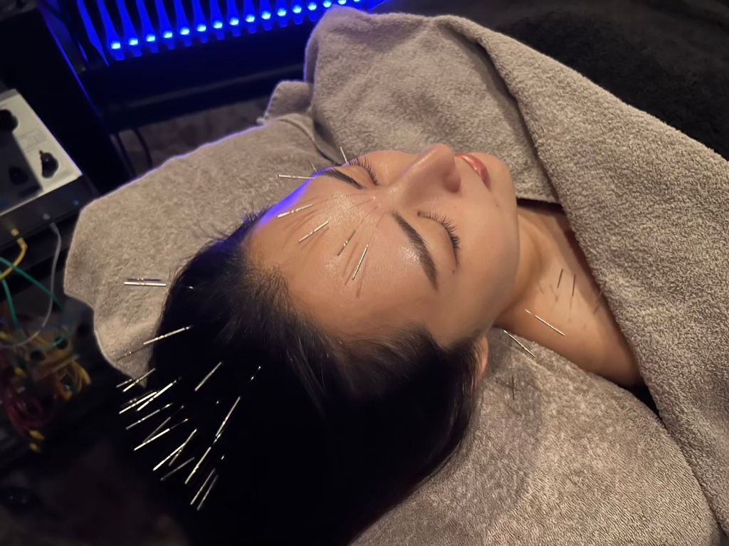 NEL 睡眠改善鍼灸院の施術風景