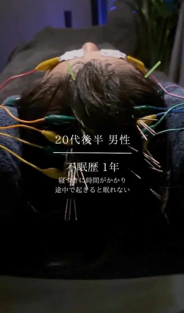 20代後半 男性 不眠症歴1年