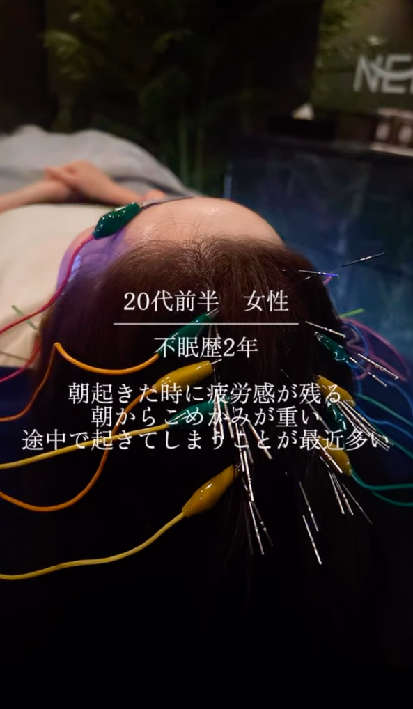 20代前半 女性 不眠症歴2年