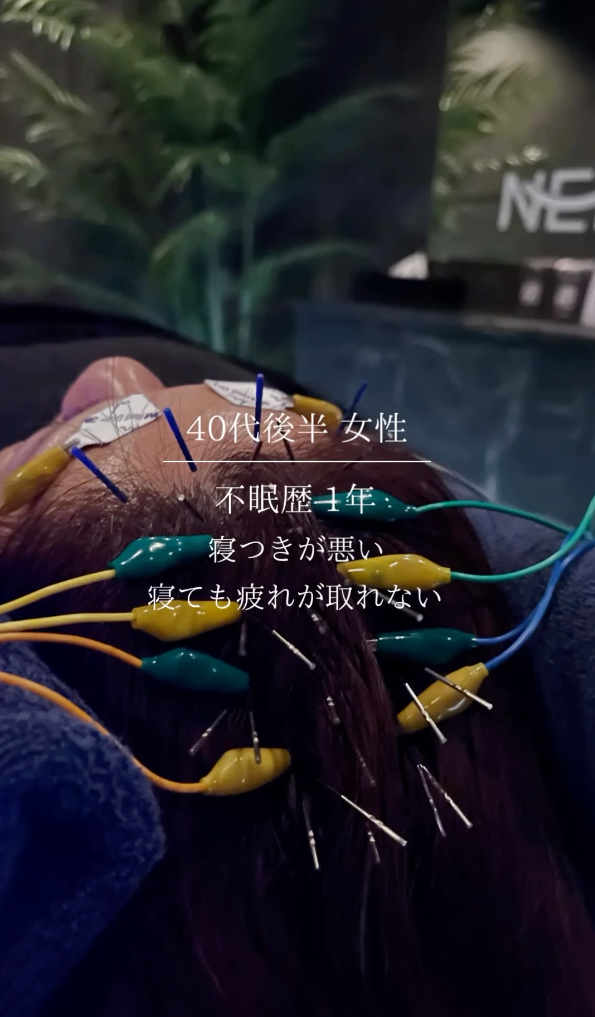 40代後半 女性 不眠症歴1年