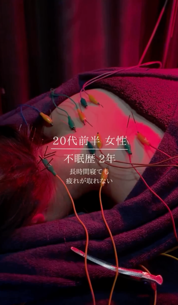 20代前半 女性 不眠症歴2年