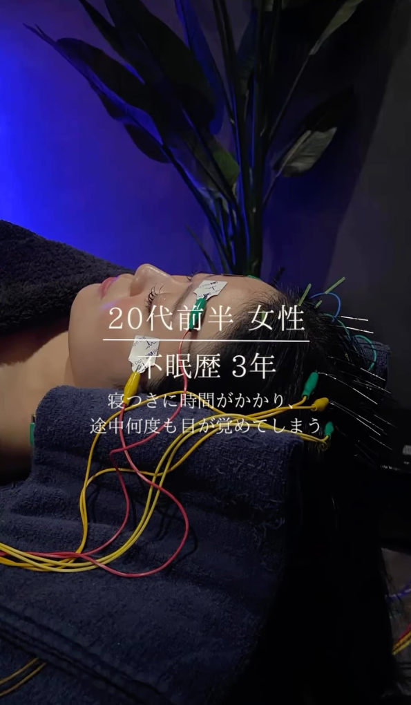 20代前半 女性 不眠症歴3年